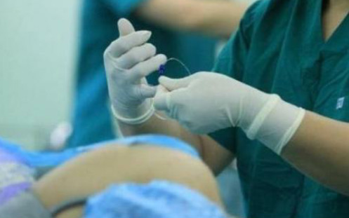 为什么顺产备皮不要刮干净,顺产还是剖腹产都要剃光头