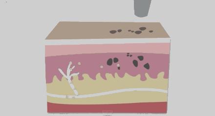 激光洗纹身出血吗,洗纹身是什么体验