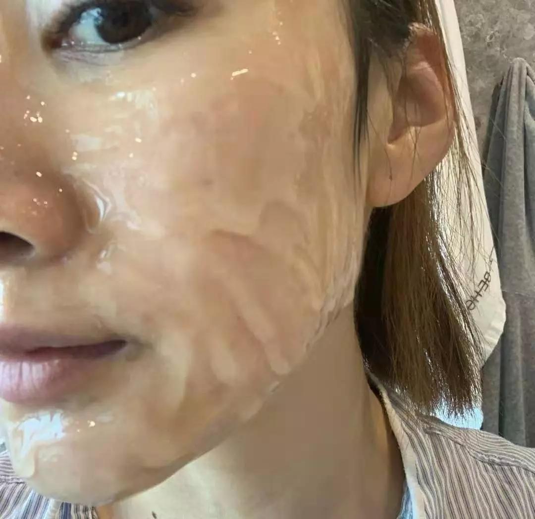 hfp收缩毛孔去黑头套装用法及步骤,白醋正确洗脸收缩毛孔