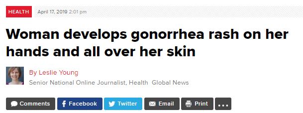 约炮软件流行加拿大某省性病大爆发