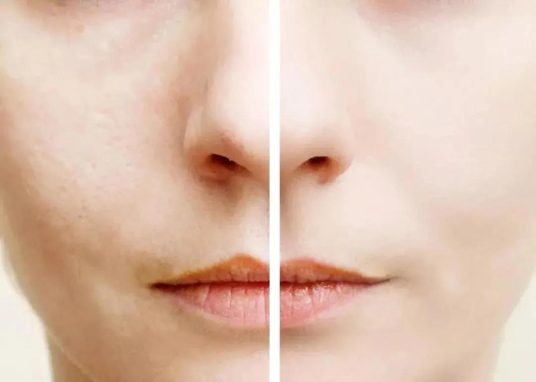 在空调屋里皮肤干燥、瘙痒、泛红，我来帮你解决