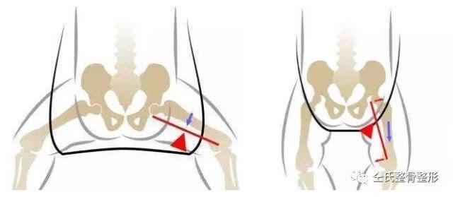 想要孩子长得好看怎么办,想要孩子长得好看要吃什么