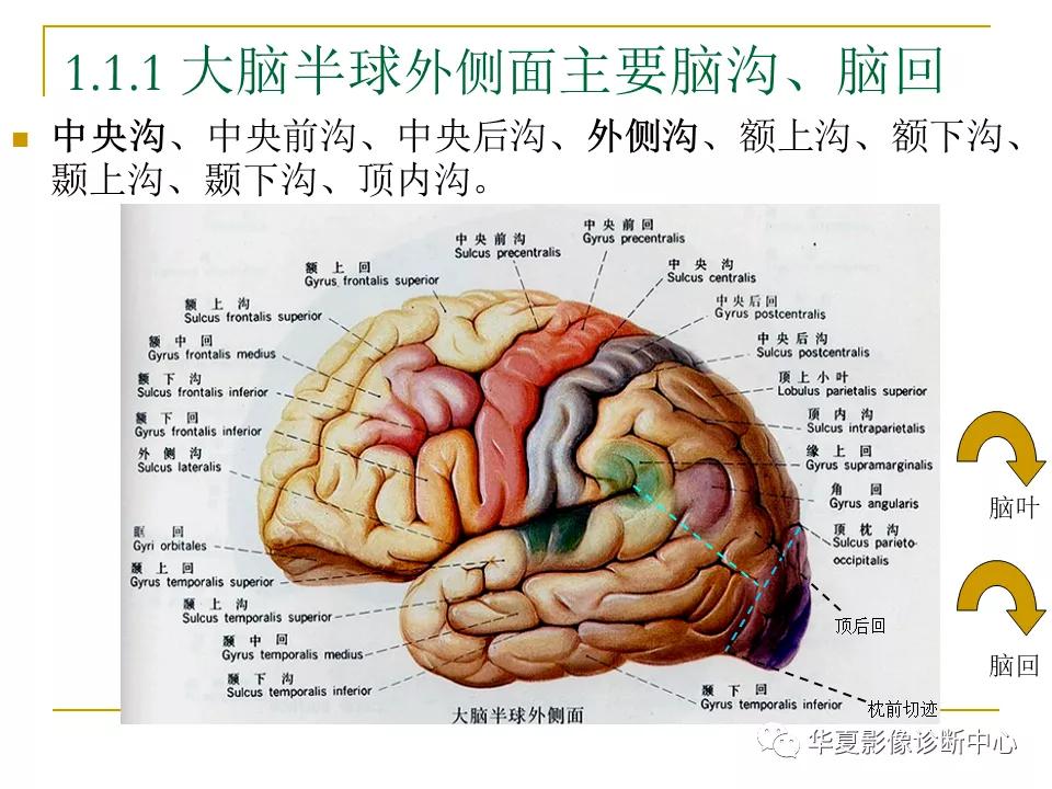 中国人脑立体定向mri应用解剖图谱,脑mri示意图