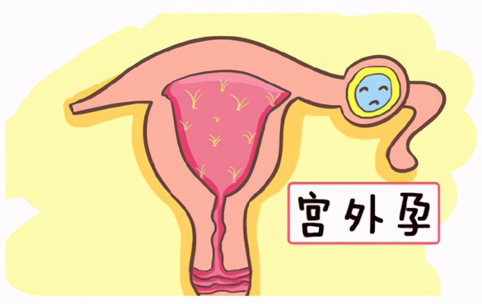 早期妊娠疾病您了解多少?