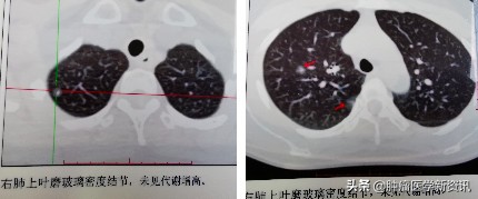 抗癌物质能治愈癌症吗,抗癌成功的几率有多大