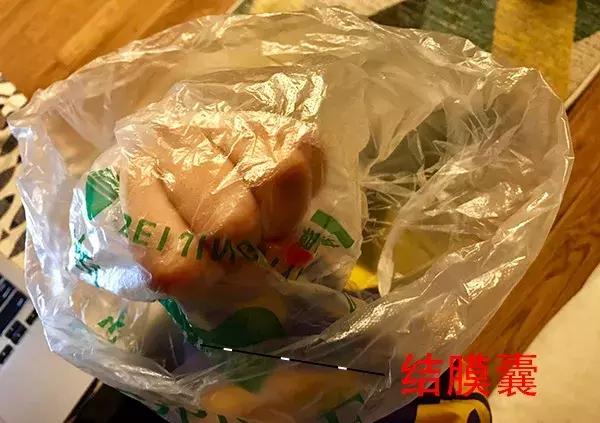 戴上隐形眼镜但是找不到了,隐形眼镜没有摘但是找不到了