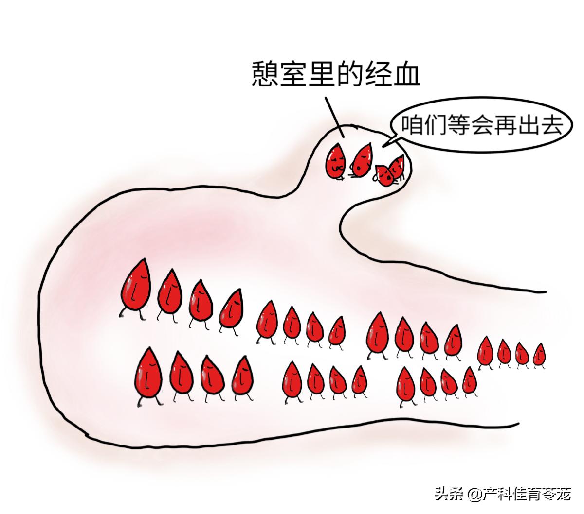 剖腹产后子宫出血是正常的吗,剖宫产术后又流血