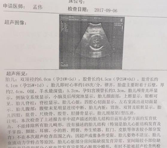 备孕无果要注意什么,备孕苦尽甘来