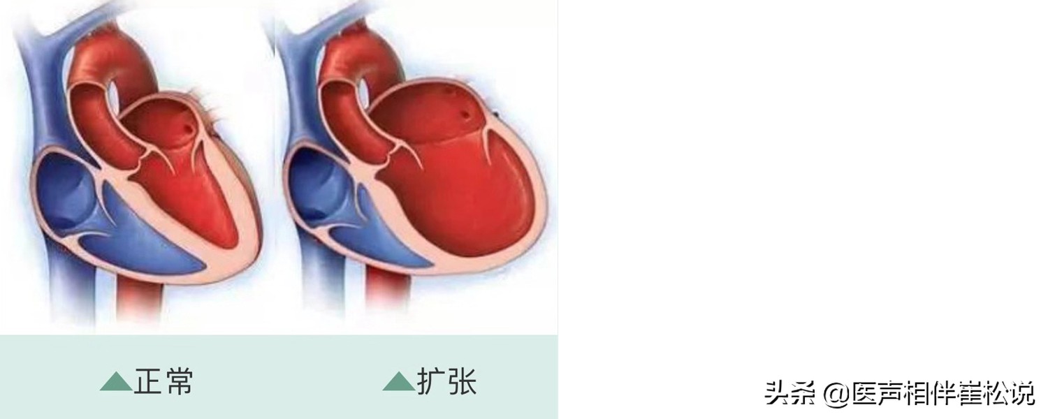 这份心脏说明书请收好,心脏保健手册