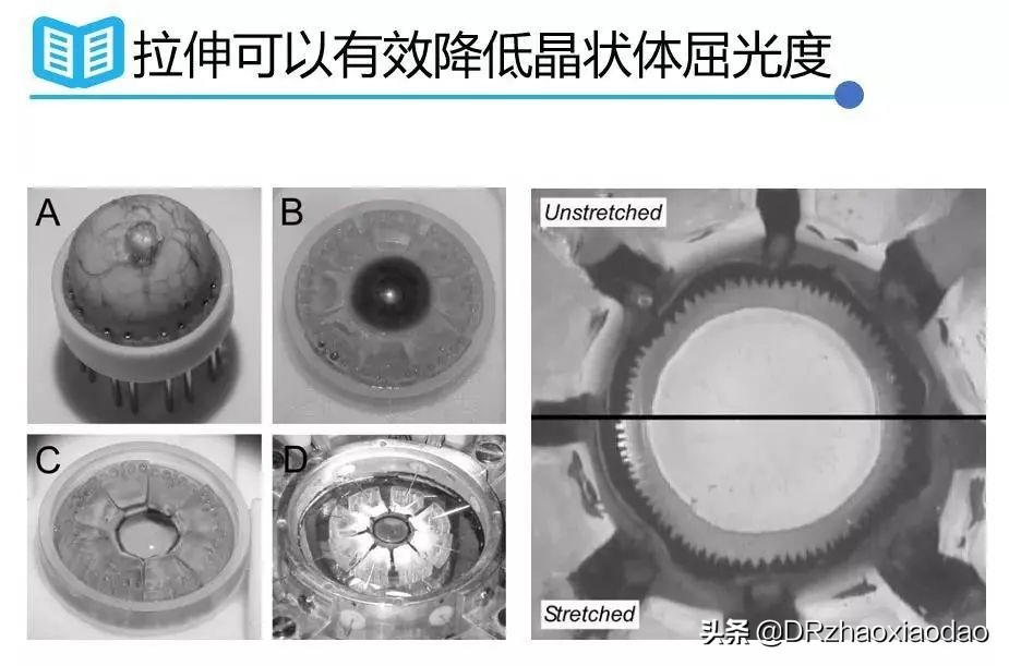 儿童近视按摩提高视力,提高视力的按摩手法