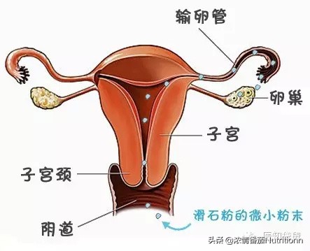 爽身粉中有铅吗,使用爽身粉致癌