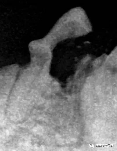 猫咪牙齿发炎最好的方法,猫咪牙齿有哪些问题