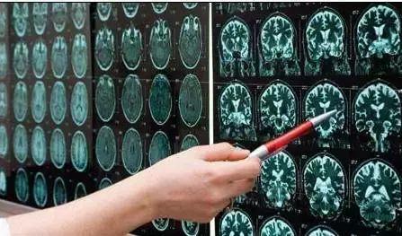 x光b超ct核磁共振区别,收藏这篇就够了