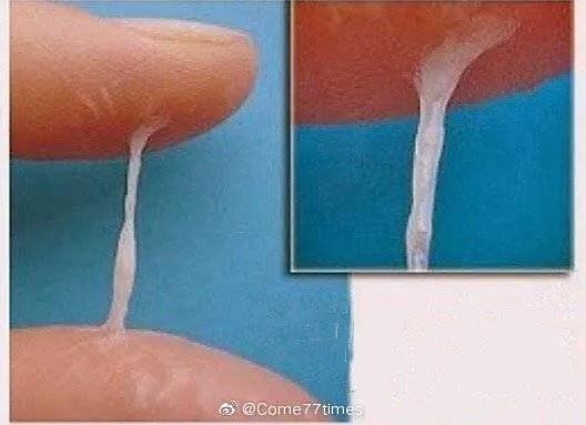 女性白带的危险信号,白带是精子形成的吗