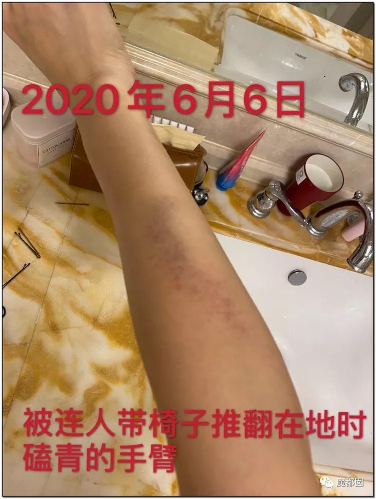 短跑名将张培萌家暴事件,短跑名将张培萌殴打岳母视频