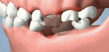 牙齿那些事微课,牙齿的问题都是小事