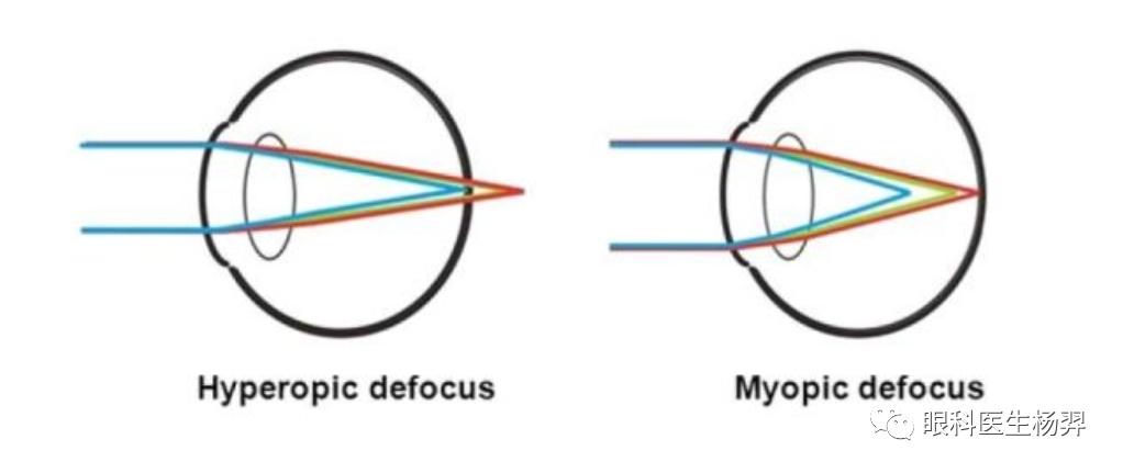 户外活动为什么能防控近视,户外活动防控近视背后的秘密