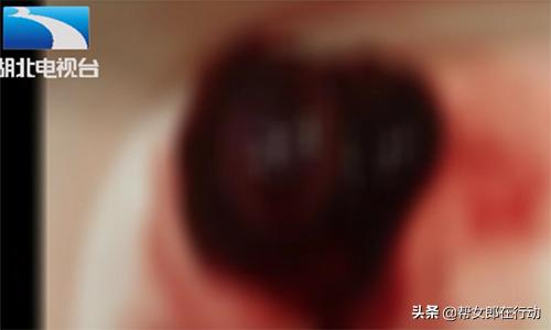 她做了3次试管怀孕，均以失败告终，检验流产胚胎竟被放坏？