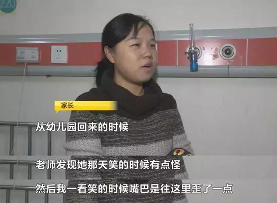 3岁宝宝突发面瘫，儿童、寒冷、风大，更易面瘫？