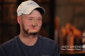 手术的时候医生对你做了什么,手术时切了一片肺叶