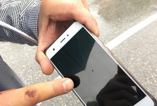 路面坑不平骑车人摔伤,因为路有坑骑车摔跤了