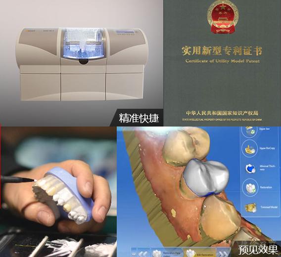 前牙折断修复流程,前牙摔断了咋修复