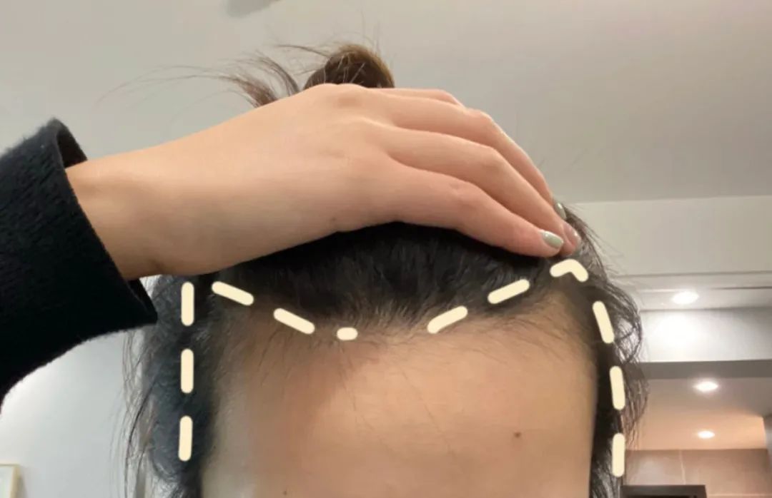 什么脸型都适合的刘海是哪种刘海,最修饰脸型的刘海简单自然减龄