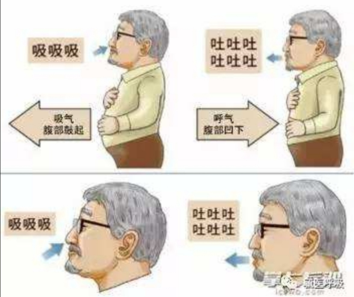 患慢阻肺能打新冠疫苗吗,重度慢阻肺感染新冠