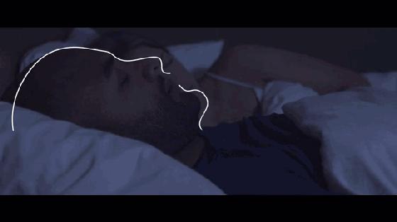 自查打鼾是否就医,打鼾查什么