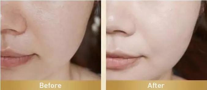 虾青素推荐新西兰,平价虾青素抗老精华