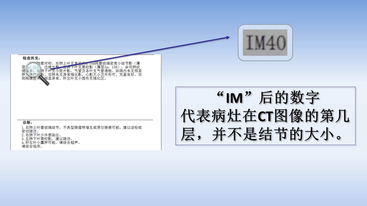 知道自己有肺结节度日如年,渡过肺结节的劫