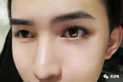 种睫毛存在哪些安全隐患,大眼睛要不要种睫毛