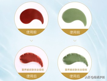 黑眼圈修复眼膜,改善多重黑眼圈眼膜