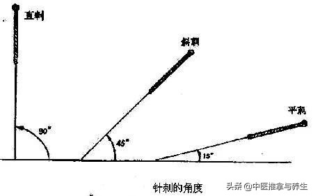 针灸绝技绝招立竿见影,针灸最狠针法