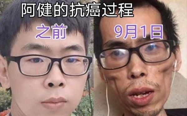 阿健要努力活着谈癌症早期症状,抗癌阿健是什么癌