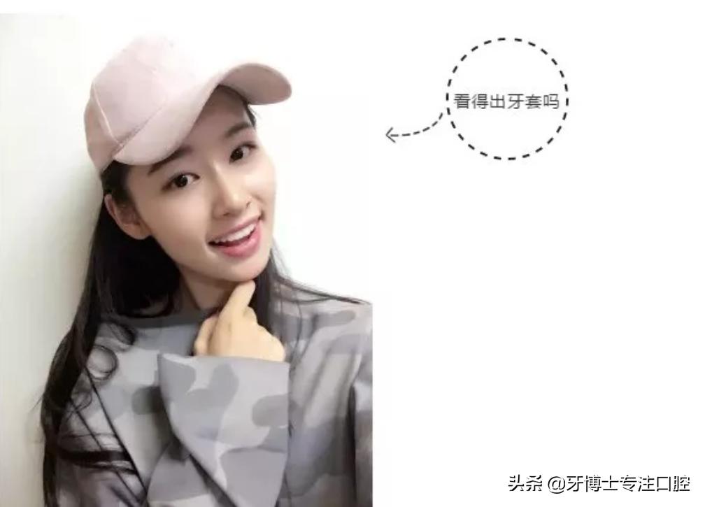 明星牙齿矫正前后对比,明星牙齿矫正都用的什么矫正方式