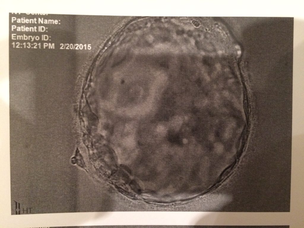 真实美国代孕案例,在美国代孕的案例很多吗