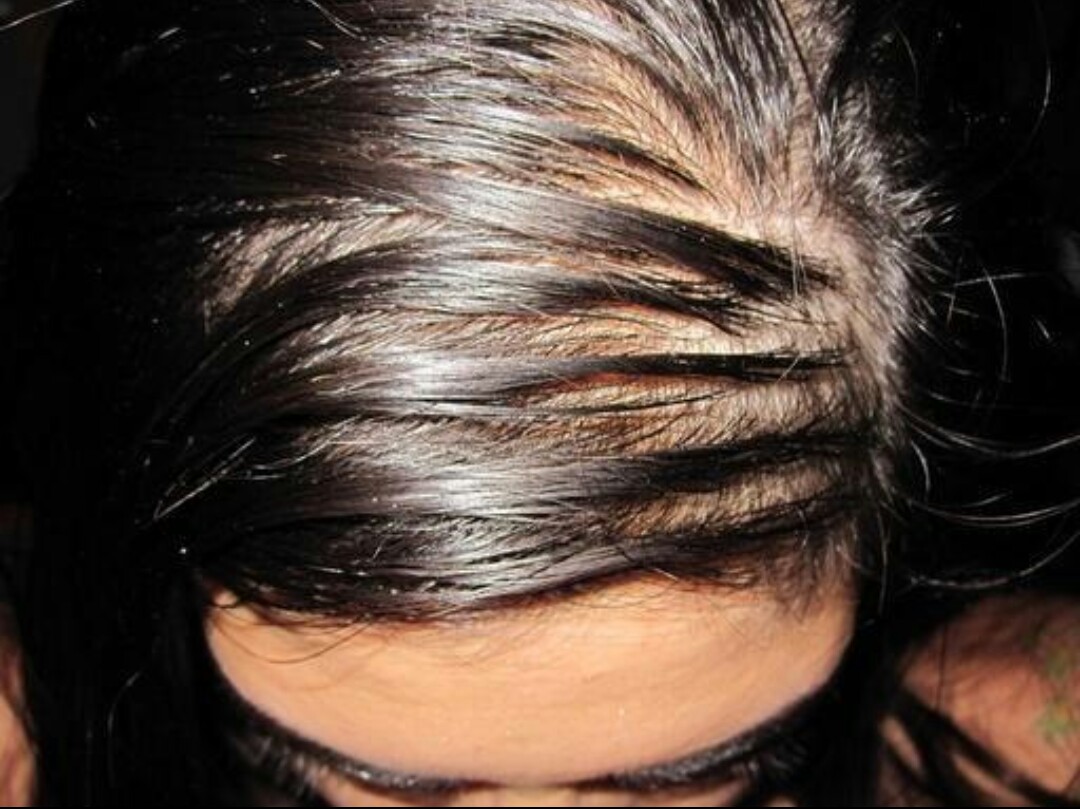 不建议用爽身粉的原因是哪些方面,如何正确使用爽身粉视频讲解一下