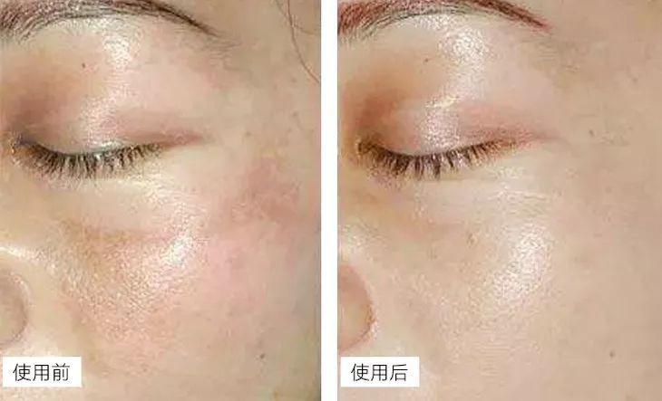 张天爱视频用的保养护肤面霜,张天爱作息曝光视频