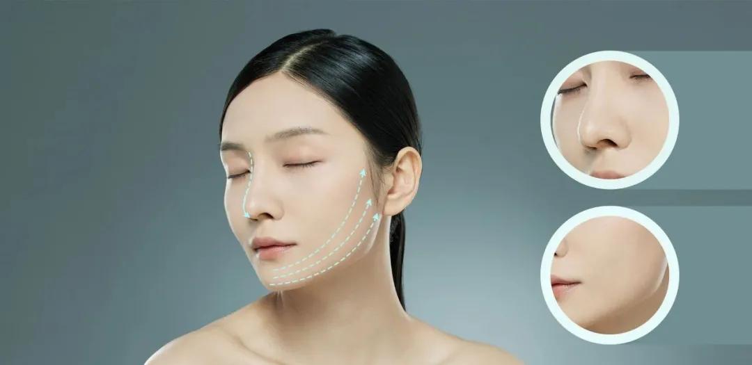 鼻子的颜值,颜值鼻子