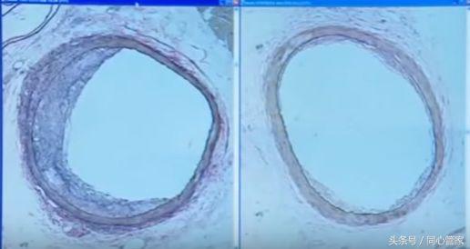 别让坏情绪毁了人生,别让负面情绪毁了你的人生