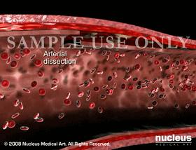 不吸烟不喝酒也会中风吗,不吸烟不喝酒为何中风