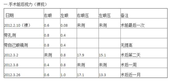 白内障问诊记录,白内障就医需要咨询什么