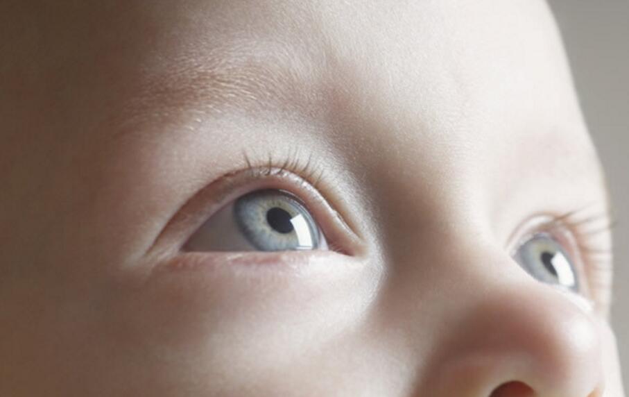 婴儿斗鸡眼怎么矫正,成年人眼睛有点斗鸡眼怎么矫正