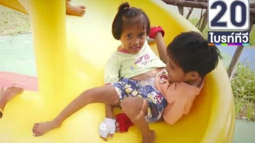 连体婴姐妹其中一个结婚了,连体姐妹一人结婚视频完整版