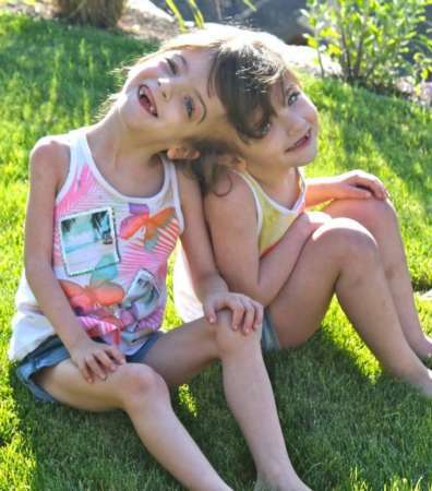 连体婴姐妹其中一个结婚了,连体姐妹一人结婚视频完整版