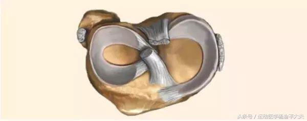 半月板撕裂手术缝两针多少钱,半月板撕裂缝1针