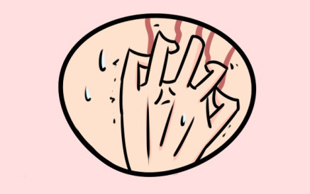 中医治疗湿疹是让湿疹发出来吗,春天湿疹用哪个中成药