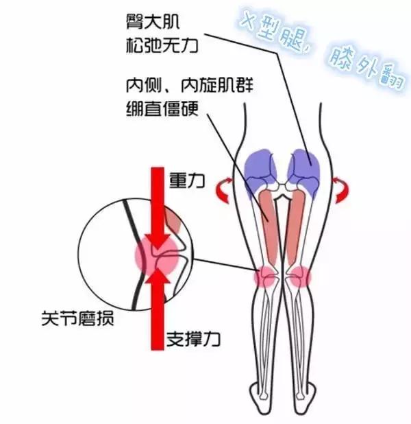 不管XO，轻松几个动作让你收获一双“维秘腿”！