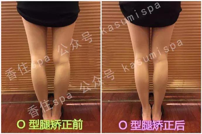 不管XO，轻松几个动作让你收获一双“维秘腿”！